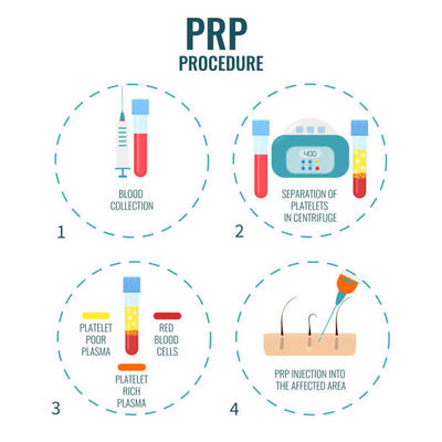 Bom preço. Veterinary Medicine:** Process animal blood for PRP therapies in equine and canine sports medicine. on-line